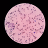 giardia